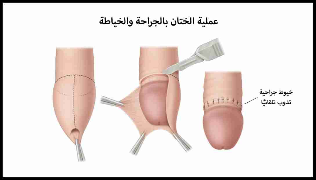 4AkEydusSSuS_1628512313.jpg