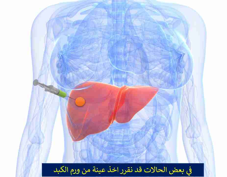 Ia2tSFZuaBUE_1660586414.jpg