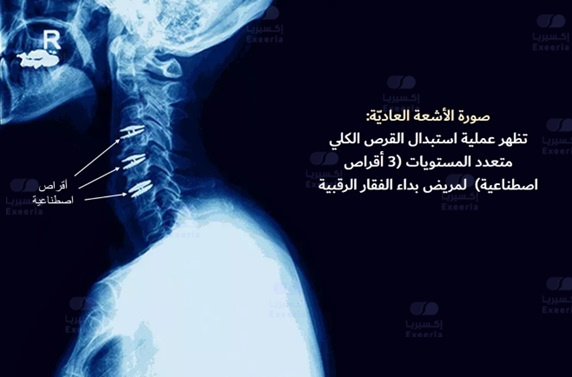 Lt2kRE1iLHp1_1675055083.jpg