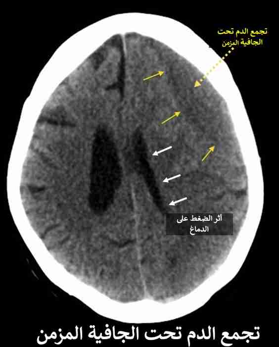 MbkNKnQqiwMH_1632040403.jpg