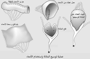 OvROCmNxafHD_1659514077.jpg