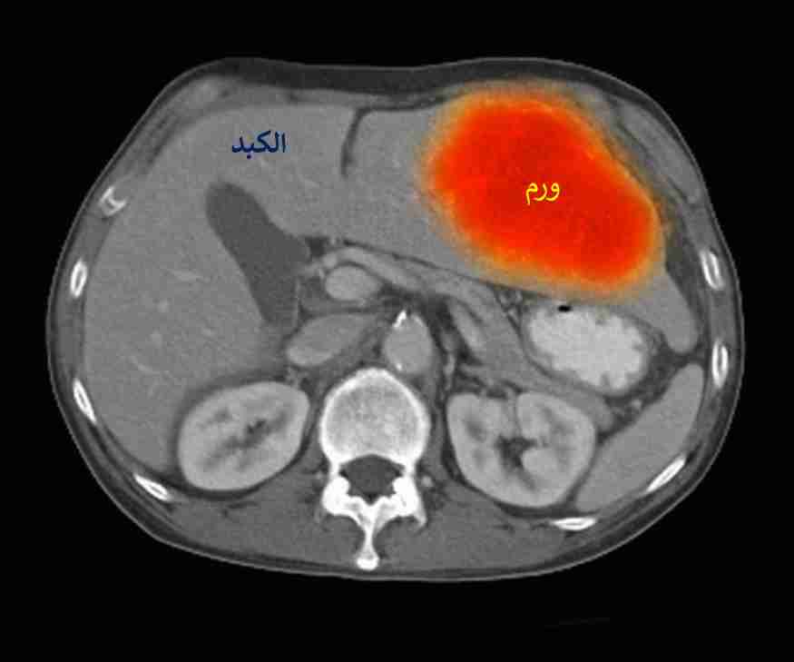 RCHI4CrJCRrb_1660586640.jpg