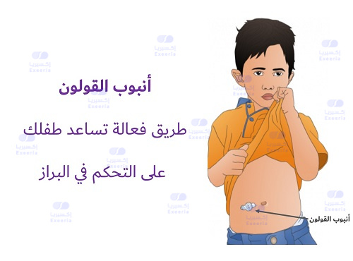topic