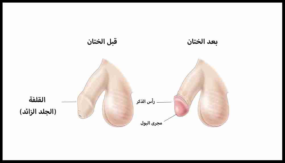 kHiZhaIlQm4a_1628512273.jpg